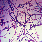 Anthrax Bacteria Colonies