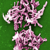 Clostridium Difficile Bacteria (Photo Credit: Janice Haney Carr)
